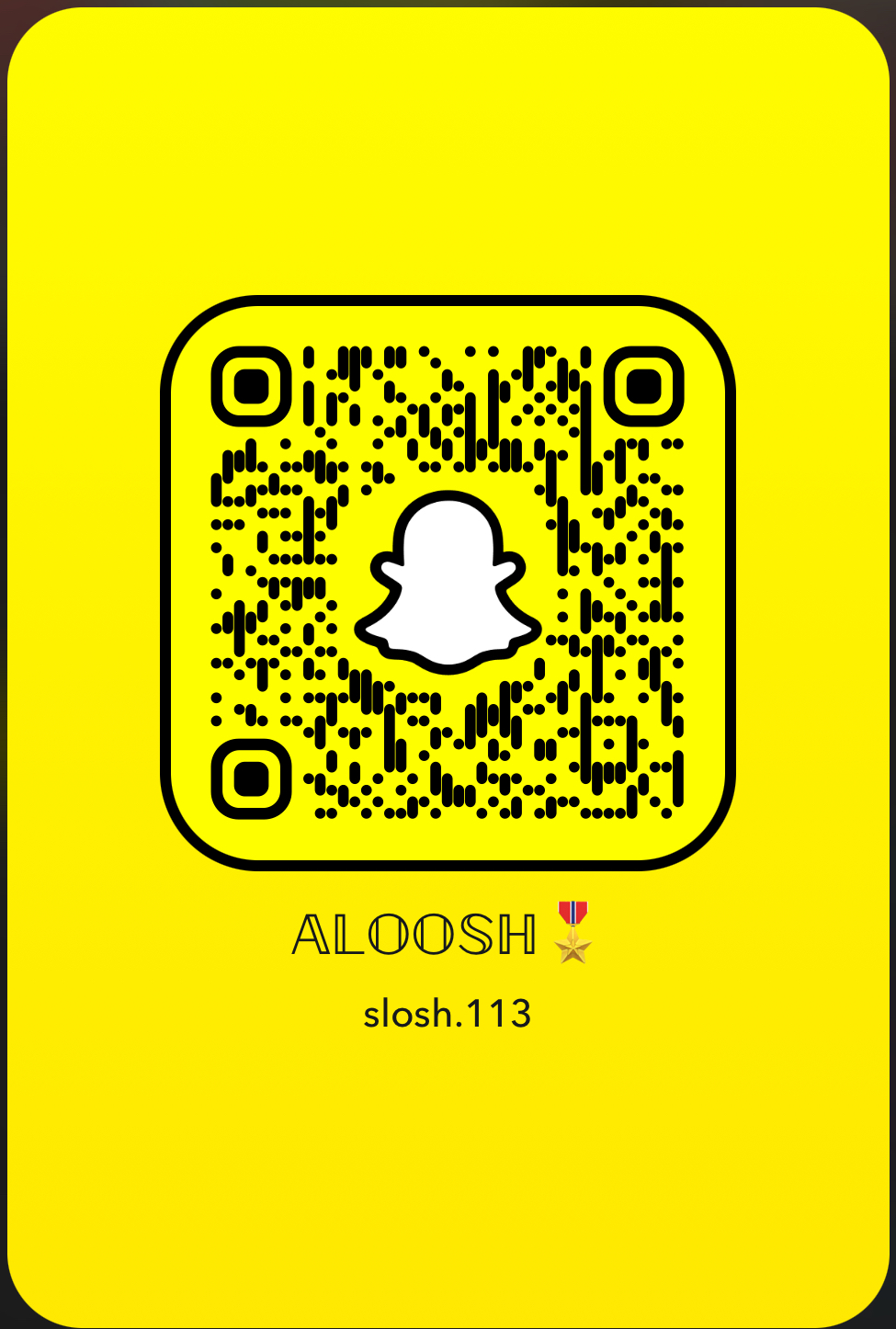 𝔸𝕃𝕆𝕆𝕊ℍ🎖